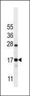 Chromosome 15 Open Reading Frame 40 antibody, PA5-48417, Invitrogen Antibodies, Western Blot image 