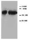 Tumor Protein P73 antibody, AP23318PU-N, Origene, Western Blot image 
