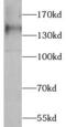 Fms Related Tyrosine Kinase 1 antibody, FNab09393, FineTest, Western Blot image 