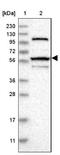 Zinc Finger Protein 454 antibody, NBP1-81948, Novus Biologicals, Western Blot image 