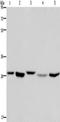 Enoyl-CoA hydratase, mitochondrial antibody, TA349915, Origene, Western Blot image 