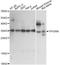 TP53 Regulating Kinase antibody, A14952, ABclonal Technology, Western Blot image 