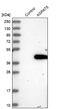1-Acylglycerol-3-Phosphate O-Acyltransferase 5 antibody, NBP1-83768, Novus Biologicals, Western Blot image 