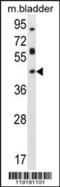 Homeobox D13 antibody, 55-716, ProSci, Western Blot image 