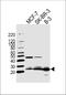 Family With Sequence Similarity 216 Member B antibody, A18943, Boster Biological Technology, Western Blot image 
