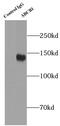 Multidrug resistance protein 1 antibody, FNab09805, FineTest, Immunoprecipitation image 