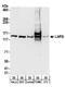 Leucyl-tRNA synthetase, cytoplasmic antibody, A304-315A, Bethyl Labs, Western Blot image 