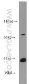 Mannose Phosphate Isomerase antibody, 14234-1-AP, Proteintech Group, Western Blot image 