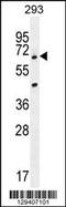 Ankyrin Repeat Domain 34B antibody, 55-885, ProSci, Western Blot image 