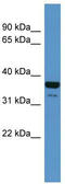 CD200 Receptor 1 antibody, TA342750, Origene, Western Blot image 