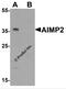 Aminoacyl tRNA synthase complex-interacting multifunctional protein 2 antibody, 7515, ProSci, Western Blot image 
