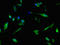 6-phosphofructokinase, liver type antibody, orb46027, Biorbyt, Immunocytochemistry image 