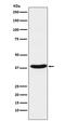 NADH-ubiquinone oxidoreductase chain 1 antibody, M02292, Boster Biological Technology, Western Blot image 