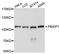 PBX Homeobox Interacting Protein 1 antibody, A07944, Boster Biological Technology, Western Blot image 