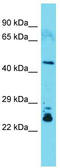 Cytohesin 1 Interacting Protein antibody, TA343214, Origene, Western Blot image 