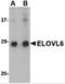 ELOVL Fatty Acid Elongase 6 antibody, 4571, ProSci, Western Blot image 