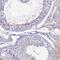 Adhesion G Protein-Coupled Receptor A1 antibody, NBP1-82890, Novus Biologicals, Immunohistochemistry frozen image 