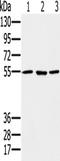 Proteasome 26S Subunit, ATPase 1 antibody, TA350304, Origene, Western Blot image 