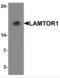 Late Endosomal/Lysosomal Adaptor, MAPK And MTOR Activator 1 antibody, NBP2-82075, Novus Biologicals, Western Blot image 
