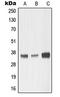 Matrix Metallopeptidase 23B antibody, LS-C353062, Lifespan Biosciences, Western Blot image 
