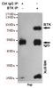 Bruton Tyrosine Kinase antibody, LS-B14229, Lifespan Biosciences, Immunoprecipitation image 