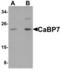 Calcium-binding protein 7 antibody, LS-B5311, Lifespan Biosciences, Western Blot image 