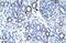Transmembrane Protein 259 antibody, A10096, Boster Biological Technology, Immunohistochemistry paraffin image 