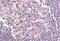 BCL2 Related Protein A1 antibody, MBS240482, MyBioSource, Immunohistochemistry paraffin image 