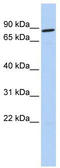Forkhead box protein P4 antibody, TA329325, Origene, Western Blot image 