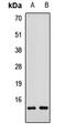 Small muscular protein antibody, LS-C668392, Lifespan Biosciences, Western Blot image 