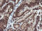 Von Hippel-Lindau Tumor Suppressor antibody, M00079, Boster Biological Technology, Immunohistochemistry paraffin image 