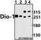 Death Inducer-Obliterator 1 antibody, A06019S186, Boster Biological Technology, Western Blot image 