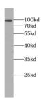 Exocyst Complex Component 2 antibody, FNab07684, FineTest, Western Blot image 