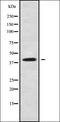 Mitochondrial Calcium Uniporter antibody, orb338199, Biorbyt, Western Blot image 