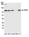 Serine/Threonine Kinase 33 antibody, A305-676A-M, Bethyl Labs, Western Blot image 