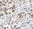Poly(ADP-Ribose) Polymerase 1 antibody, ab32064, Abcam, Immunohistochemistry paraffin image 