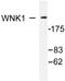 WNK1 antibody, AP06363PU-N, Origene, Western Blot image 