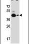 Calcitonin Receptor antibody, PA5-25594, Invitrogen Antibodies, Western Blot image 