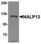 NLR Family Pyrin Domain Containing 13 antibody, orb75493, Biorbyt, Western Blot image 