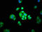 Alcohol Dehydrogenase 1A (Class I), Alpha Polypeptide antibody, LS-C669693, Lifespan Biosciences, Immunofluorescence image 