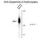 Dopamine Beta-Hydroxylase antibody, GTX82708, GeneTex, Western Blot image 
