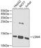LSM4 Homolog, U6 Small Nuclear RNA And MRNA Degradation Associated antibody, 15-090, ProSci, Western Blot image 