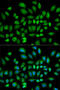 Phosphodiesterase 4D antibody, 15-277, ProSci, Immunofluorescence image 