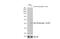 LYN Proto-Oncogene, Src Family Tyrosine Kinase antibody, GTX130454, GeneTex, Western Blot image 