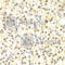 Damage Specific DNA Binding Protein 2 antibody, A1848, ABclonal Technology, Immunohistochemistry paraffin image 