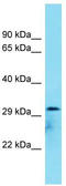 Chromosome 8 Open Reading Frame 74 antibody, TA334805, Origene, Western Blot image 