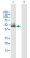 Solute Carrier Family 25 Member 23 antibody, H00079085-B01P, Novus Biologicals, Western Blot image 