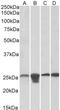 Superoxide Dismutase 2 antibody, orb22499, Biorbyt, Western Blot image 