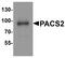 Phosphofurin Acidic Cluster Sorting Protein 2 antibody, PA5-72866, Invitrogen Antibodies, Western Blot image 
