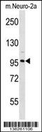 Chloride Voltage-Gated Channel 2 antibody, 58-678, ProSci, Western Blot image 